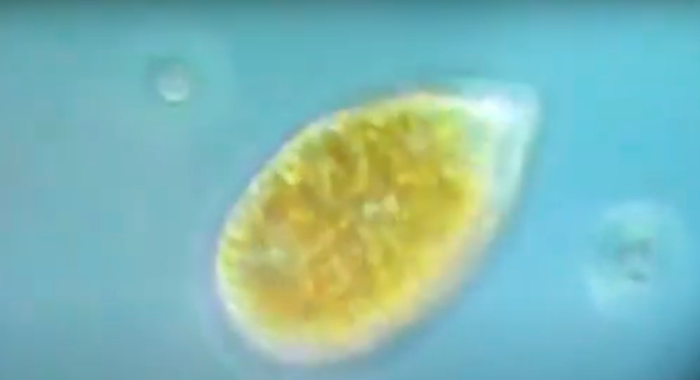 Civitavecchia: la presenza di una microalga tossica, impone divieto di balneazione (VIDEO) 1