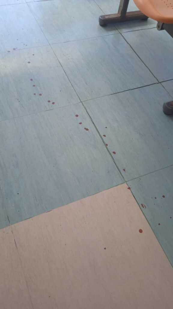 Ospedale Anzio: macchie di sangue sul pavimento. La denuncia dei pazienti 1
