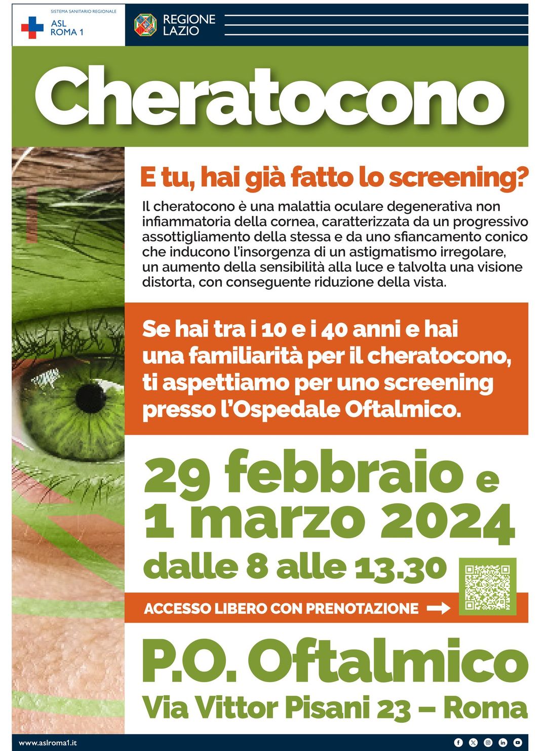 Cheratocono, due open day con screening gratis all'Oftalmico di Roma 1