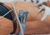Elettrocardiogramma gratuito a Santa Marinella: tre giornate di controlli e prevenzione