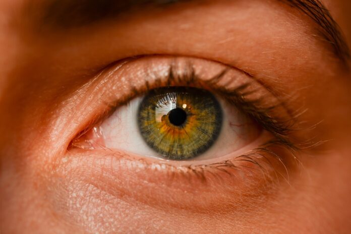 Il cheratocono è una malattia degenerativa della cornea. Open day all'Oftalmico