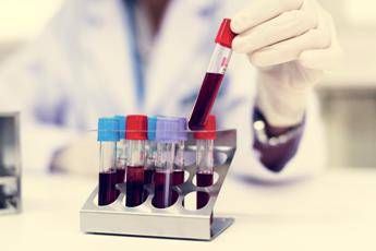 Nuovo tipo di diabete giovanile scoperto in Africa, la conferma che cambia la storia in un maxi studio