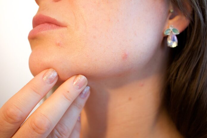 Screening dermatologico gratuito a Cerveteri: data, orari e come accedere