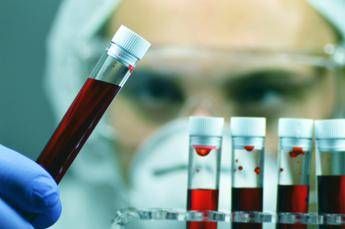 Alzheimer, allo studio esame del sangue per aiutare diagnosi precoce
