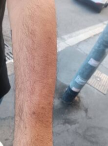 Rapina alla Garbatella, titolare di un negozio ferito da due malviventi incappucciati (FOTO) 2 Rapina alla Garbatella, titolare di un negozio ferito da due malviventi incappucciati (FOTO) 2