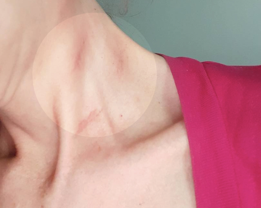 Paura a Villa Gordiani, donna minacciata e quasi strangolata per una catenina senza valore 1 Paura a Villa Gordiani, donna minacciata e quasi strangolata per una catenina senza valore 1