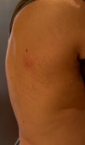 Invasione di vespe orientalis a Roma: proprietaria costretta a lasciare casa 1