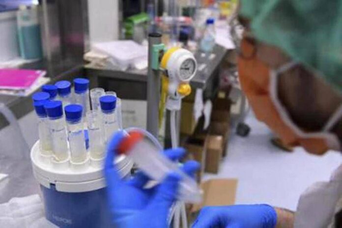 Focolaio di legionella a Milano, una casa positiva: ora si controlla l’acquedotto