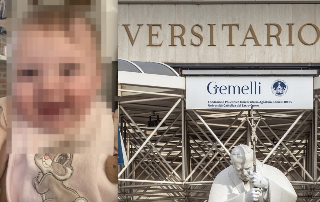 Nasce con una enorme massa sulla fronte: miracolo a lieto fine per una neonata grazie al Policlinico Gemelli 1 Nasce con una enorme massa sulla fronte: miracolo a lieto fine per una neonata grazie al Policlinico Gemelli 1
