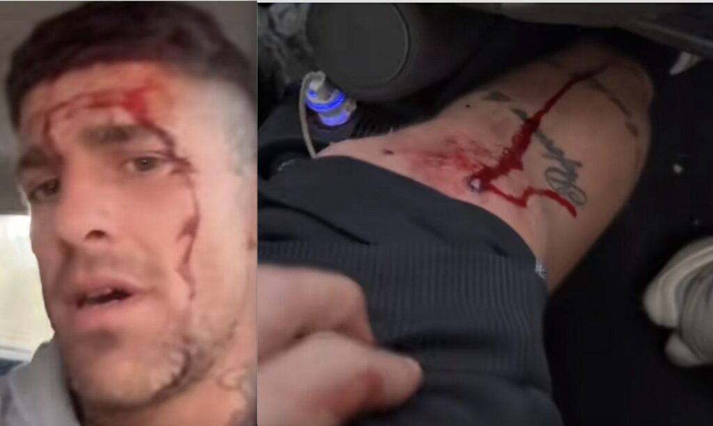 Agguato a Fonte Nuova, Manolo Casamonica fermato per il tentato omicidio del tiktoker Damiano Sartori 1 Agguato a Fonte Nuova, Manolo Casamonica fermato per il tentato omicidio del tiktoker Damiano Sartori 1
