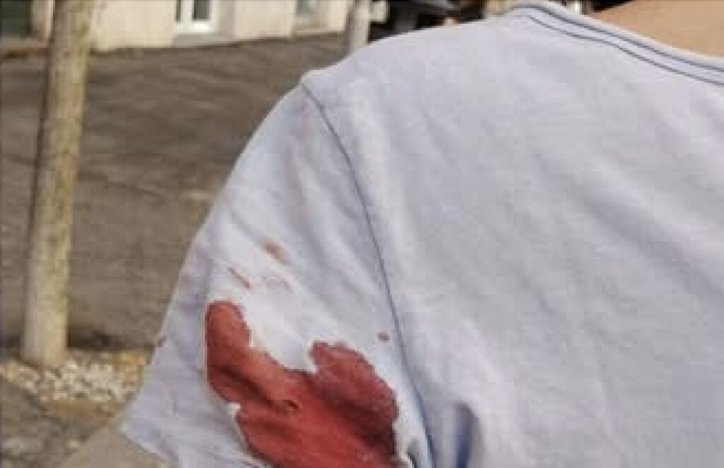 Il cecchino di Prati: «Gli spari? Un gioco, volevo solo spaventare i passanti». Ora pronto a risarcire 1
