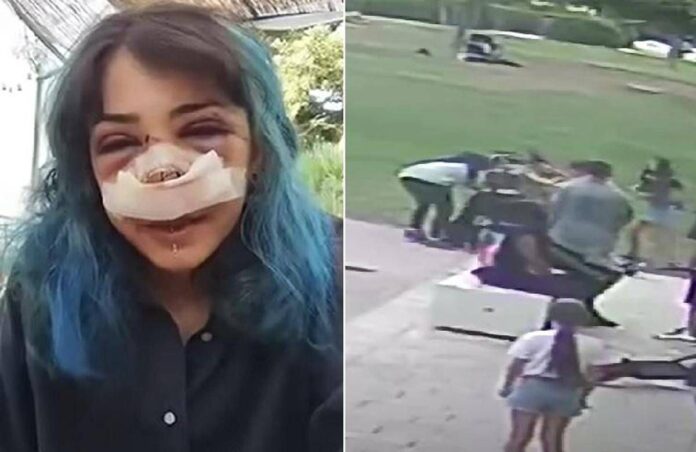 Picchiata al Parco Rossani, processo al via il 4 novembre: la 26enne ha pubblicato il video dell’aggressione